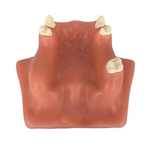 Genel Üst Çene Sinüs Kaldırma İmplantları Restorasyon Diş Uygulama Modeli